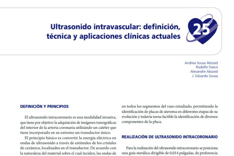 Ultrasonido intravascular