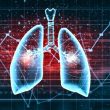 Impacto negativo de la hipertensión pulmonar en el TAVI