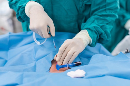 Pre-acondicionamiento isquémico en angioplastia carotídea