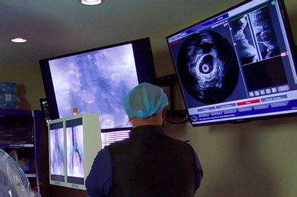 IVUS en las lesiones coronarias complejas