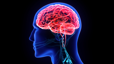 A proteção cerebral em TAVI continua com evidência débil, porém gerando expectativas