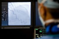 La angioplastia “ad hoc” durante el TAVI no impacta en su seguridad ni en resultados a largo plazo