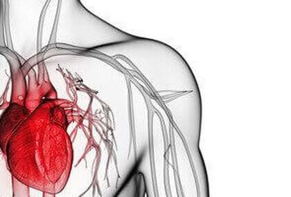¿Cuál es la necesidad de cirugía cardíaca de urgencia en el TAVI?