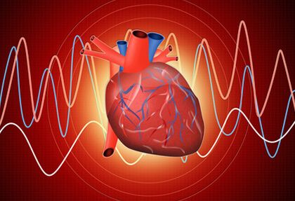 Estenosis aórtica y shock cardiogénico, ¿Es el TAVI una opción?
