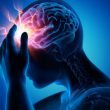 Síndrome de Hiperperfusión cerebral post-angioplastia carotídea: una complicación prevenible