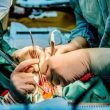 Tasa de stroke post cirugía vs angioplastia coronaria en un análisis de más de 10.000 pacientes