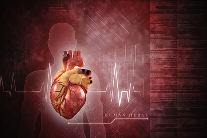 Stent directo vs angioplastia convencional y sus interacciones con la trombo-aspiración