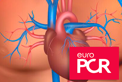 EuroPCR 2019 | La durabilidad del TAVI ofrece ciertas garantías a 8 y 10 años