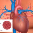 ESC 2019 | CLARIFY: Los síntomas predicen riesgo solamente en pacientes con infarto previo