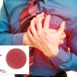 ESC 2019 | Complete: La evidencia definitiva para infartos con múltiples vasos