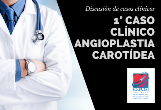 Angioplastia Carotidea