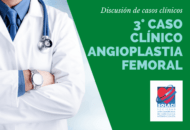 Angioplastia Femoral