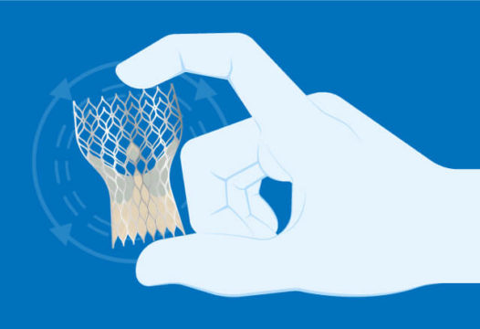 La FDA aprueba un tercer dispositivo que entra en la competencia del TAVI 