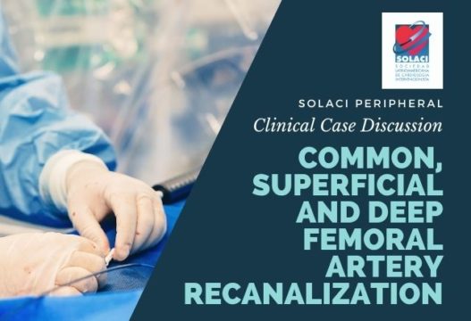 SOLACI PERIPHERAL | Common, superficial and deep femoral artery recanalization