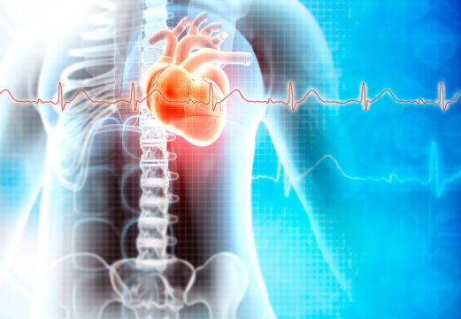 Miocardiopatía hipertrófica: análisis de una serie histórica