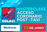 Masterclass SOLACI: Acceso Coronario Post TAVI