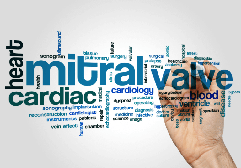 Reemplazo Percutáneo de la Válvula Mitral: ¿DOAC o VKA?