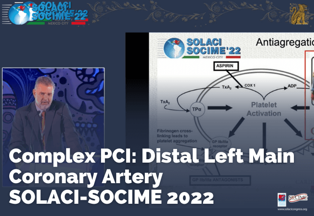 Complex PCI: Distal Left Main Coronary Artery - SOLACI-SOCIME 2022
