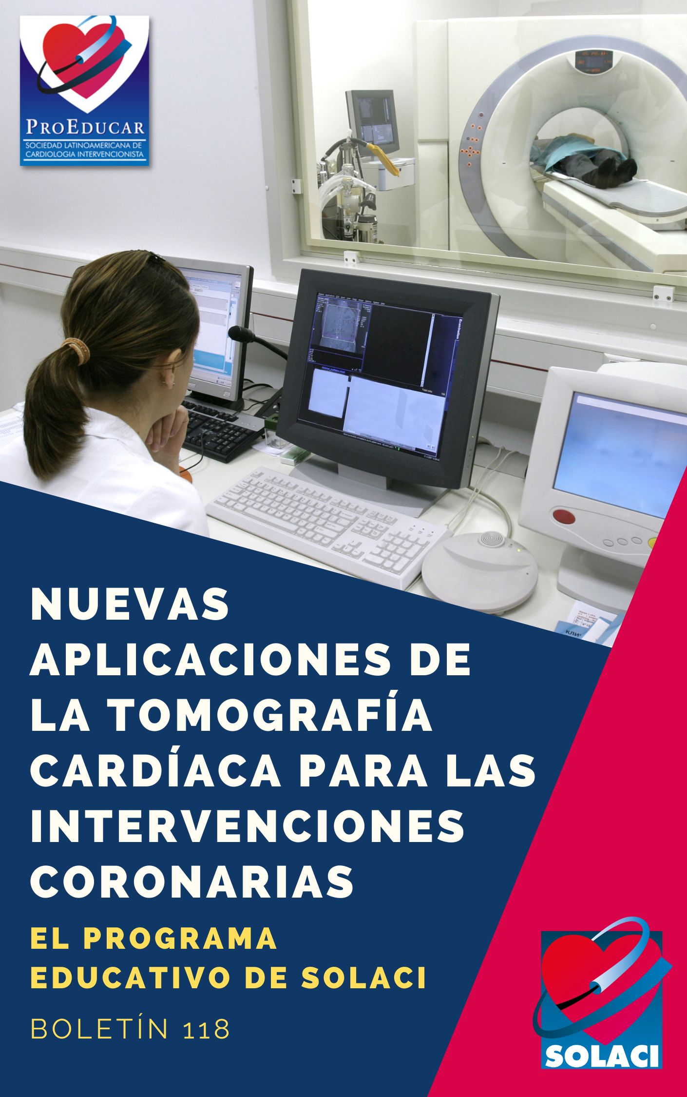 Nuevas aplicaciones de la tomografía cardíaca para las intervenciones coronarias