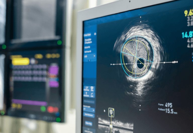 Network metaanálisis de imágenes complementarias (IVUS – OCT y angiografía convencional) para el implante de stent coronario
